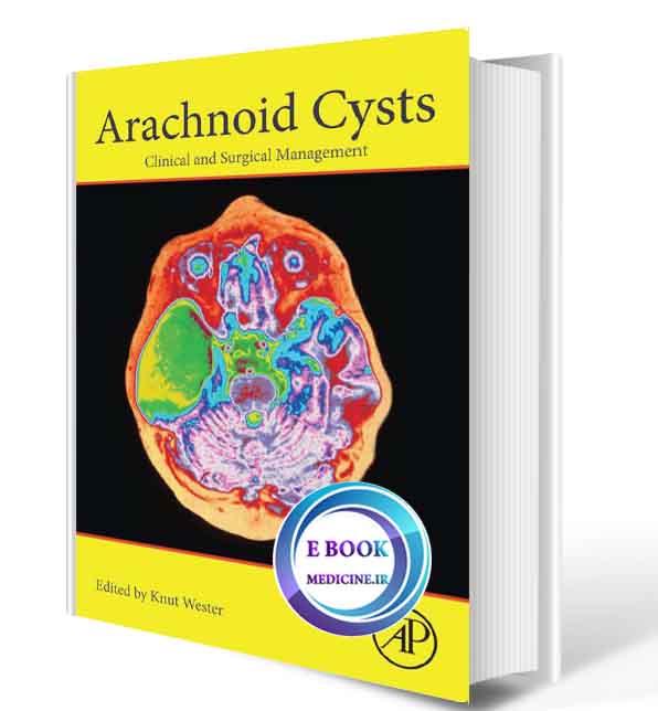 دانلود کتاب Arachnoid Cysts: Clinical and Surgical Management 2018(ORIGINAL PDF)